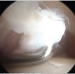 Dr. Derek Ochiai will be chairing an Instructional course on hip arthroscopy at the 6th An...